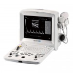 DUS 60 Ultrasound Scanner